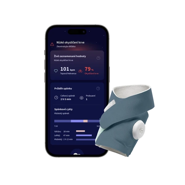 Owlet Dream Sock – Chytrá ponožka so zdravotníckou certifikáciou 0-18 mesiacov Bedtime Blue